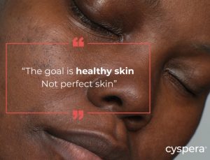 Read more about the article Cyspera Introduces Breakthrough 3-Step System Targeting Summer Hyperpigmentation.
