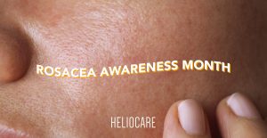 Read more about the article CELEBRATE ROSACEA AWARENESS MONTH WITH HELIOCARE